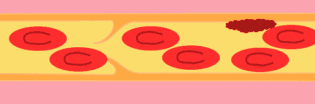 ʲôL(fng)